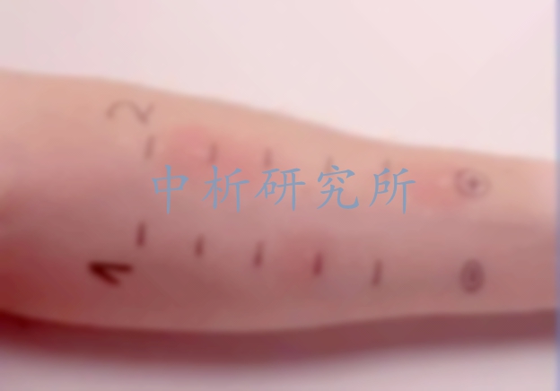 皮膚變態(tài)反應(yīng)試驗(yàn)