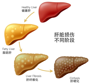 肝損傷階段