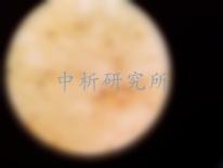 蛔蟲卵檢測