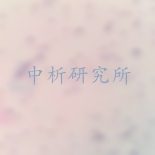 產(chǎn)氣莢膜梭菌檢測