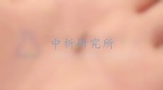 骨釘檢測(cè),骨釘檢測(cè)報(bào)告
